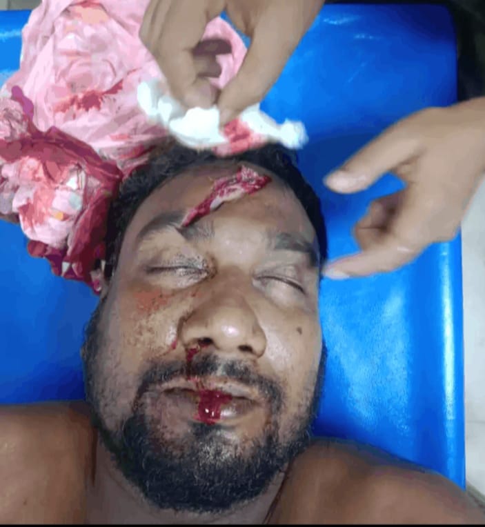 মুন্সীগঞ্জে টঙ্গীবাড়ীতে পাঁচ দিনেও হত্যা চেষ্টার মামলার আসামী গ্রেফতার হয় নি।