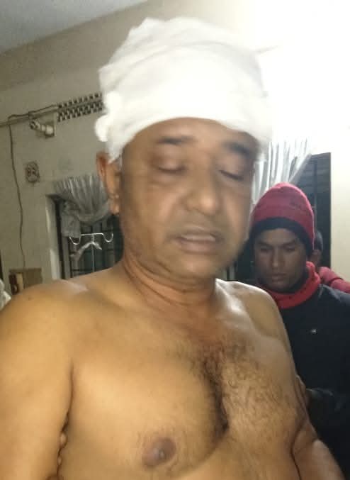 কেশবপুরে আওয়ামী লীগের সন্ত্রাসী হামলায় বিএনপি কর্মী গুরুতর জখম নগত টাকা ও স্বর্ণ লুট থানায় অভিযোগ।