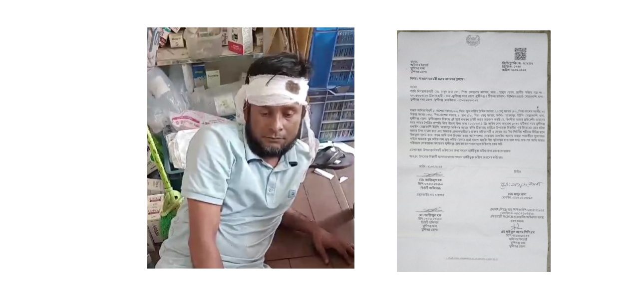 মুন্সীগঞ্জে তুচ্ছ ঘটনা কে কেন্দ্র করে সাংবাদিককে মারধরের অভিযোগ, আসামীরা এখনো ধরাছোঁয়ার বাইরে ।