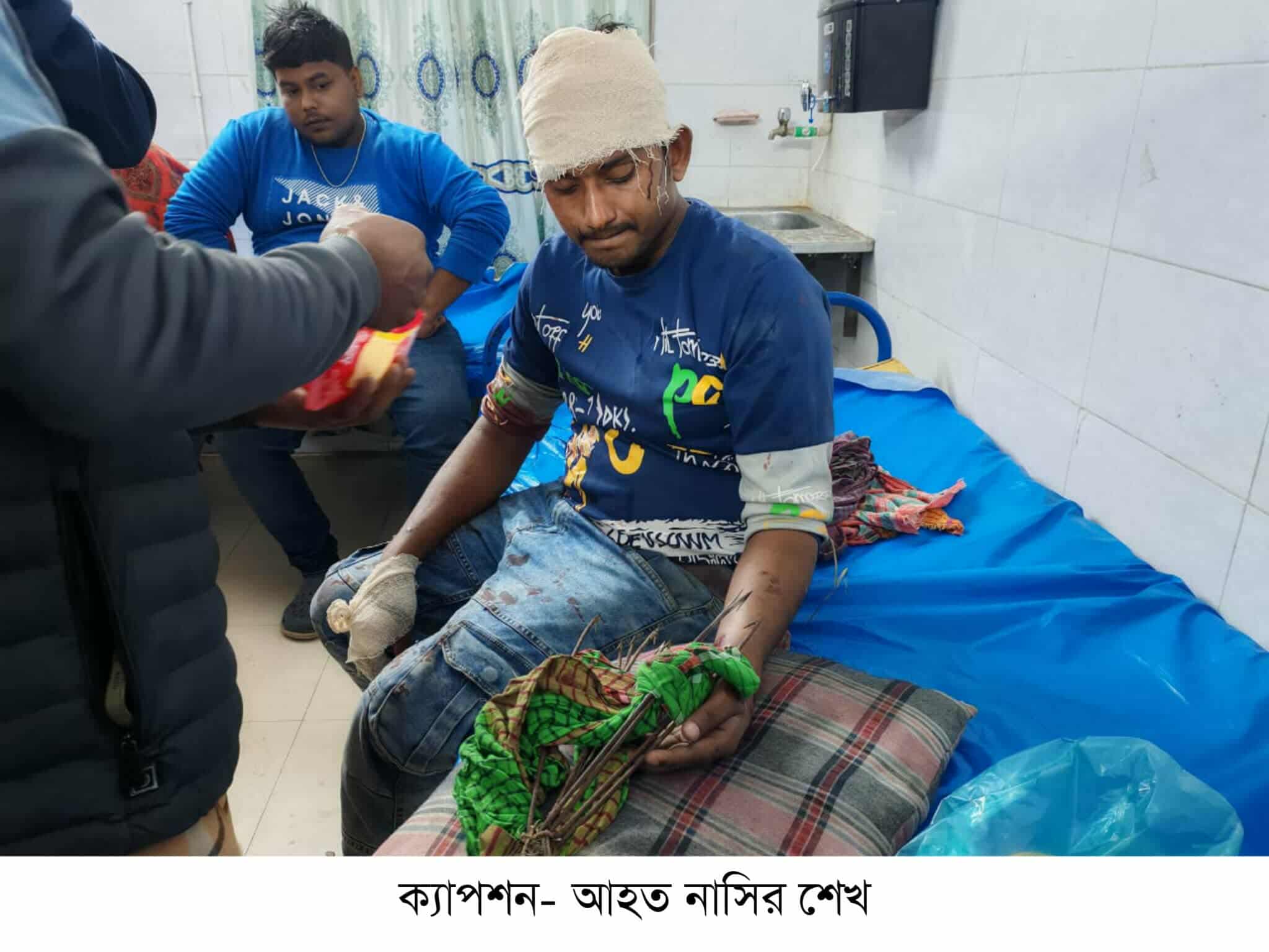 সিরাজদিখানে জমি সংক্রান্ত বিরোধের জেরে প্রতিপক্ষের হামলায় একজন টেটাবিদ্ধ